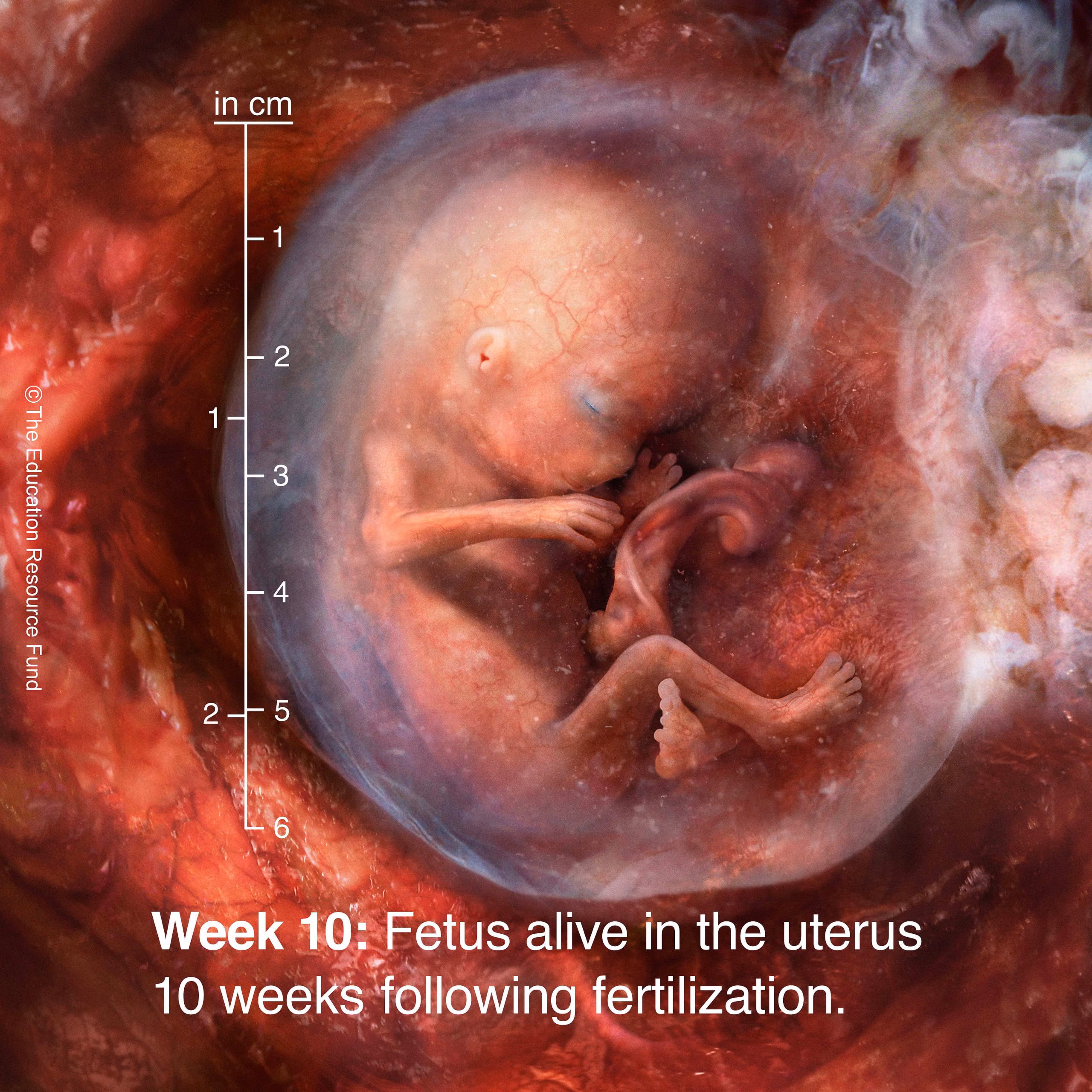Composite image of fetus at 10 weeks